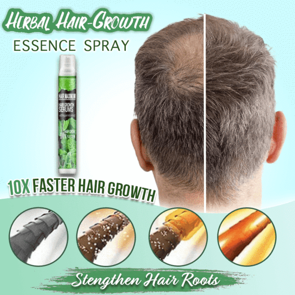 Herbal Hair-Growth Essence Spray【HOT SALE-45%OFF🔥🔥🔥】(Express 3 Day Delivery)