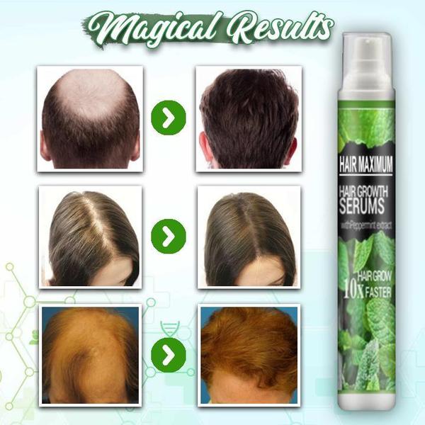 Herbal Hair-Growth Essence Spray【HOT SALE-45%OFF🔥(Express 3 Day Delivery)】