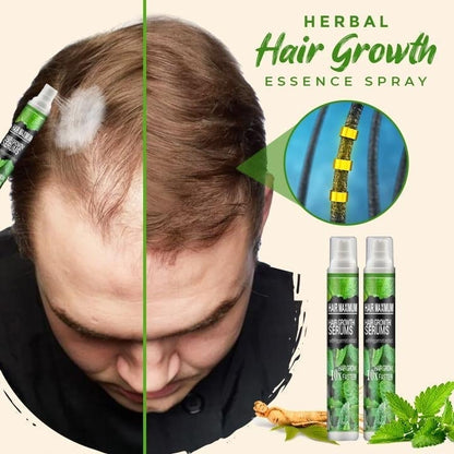 Herbal Hair-Growth Essence Spray【HOT SALE-45%OFF🔥🔥🔥】(Express 3 Day Delivery)